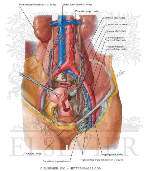 Lymph Vessels and Nodes of Pelvis and Genitalia: Female
Lymphatic Drainage II - Internal Genitalia