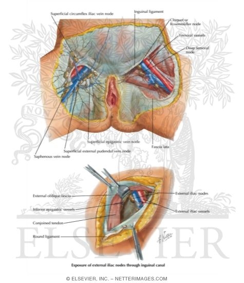 Lymphatic Drainage III: External Genitalia