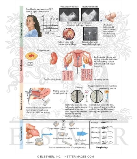 Infertility II: Evaluation Female