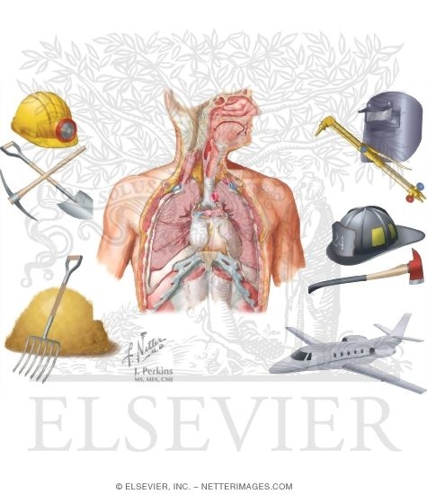 Overview of Inhalation Diseases