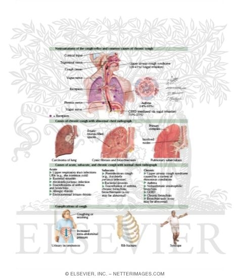 Chronic Cough