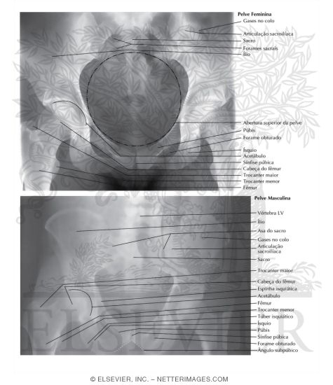 Radiografias das Pelves Feminina e Masculina