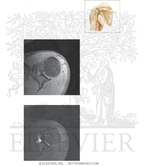 Cross Section of the Shoulder: Axial View