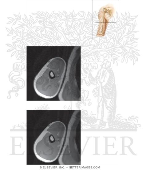 Cross Section of the Arm: Axial View