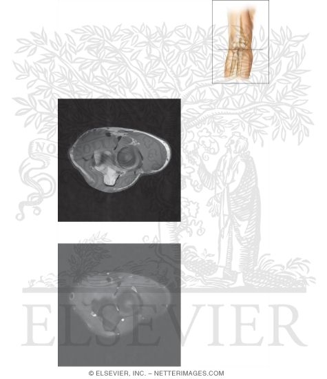 Cross Section of the Elbow: Axial View
