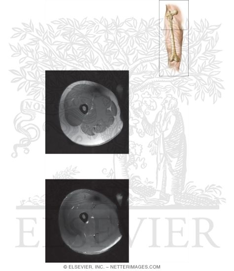 Cross Section of the Thigh: Axial View
