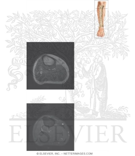 Cross Section of the Lower Leg: Axial View