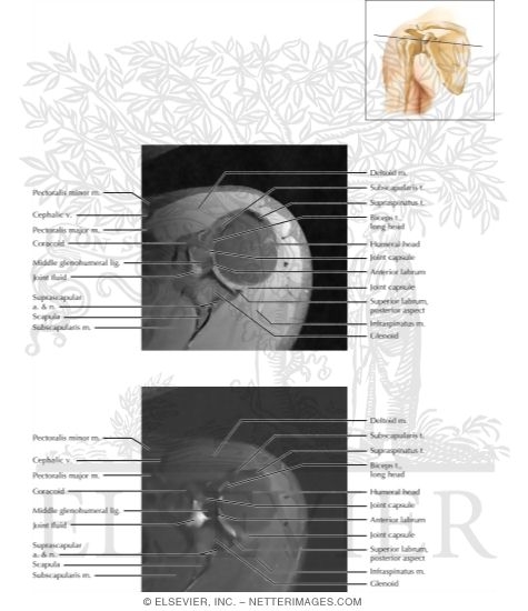Shoulder Axial 4