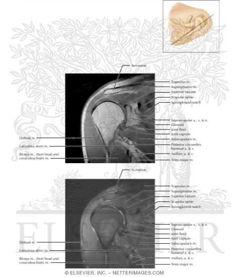 Shoulder Coronal 6
