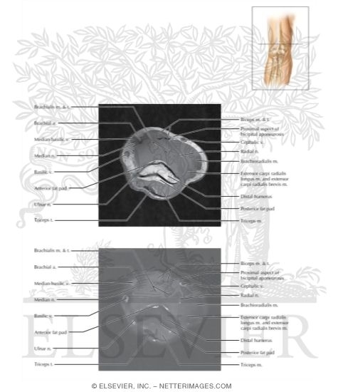 Elbow Axial 1