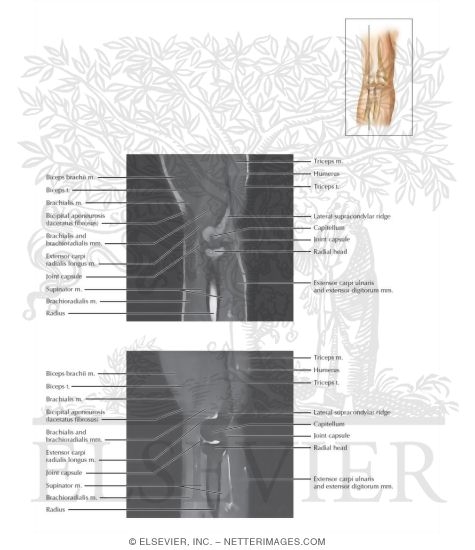 Elbow Sagittal 10