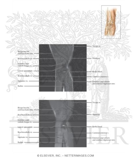 Cross Section of the Elbow: Sagittal View