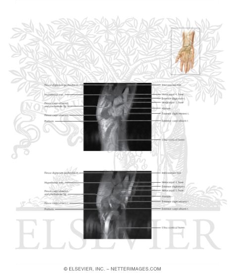 Wrist Sagittal 2