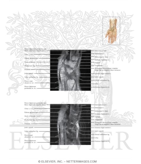 Wrist Sagittal 5