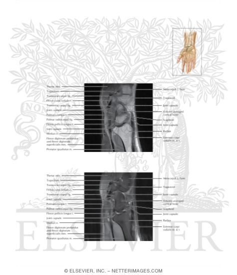 Wrist Sagittal 10