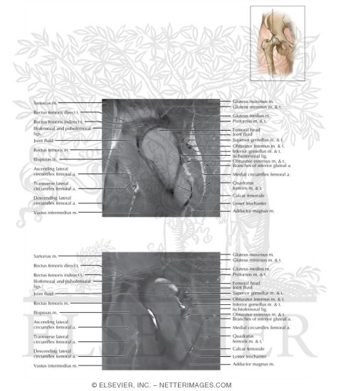 Hip Sagittal 4