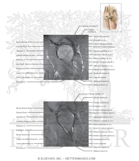 Hip Sagittal 5