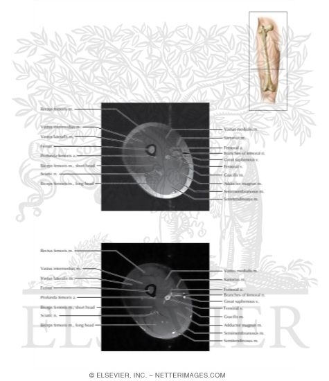 Thigh Axial 5