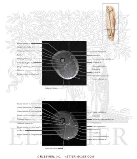 Thigh Axial 6