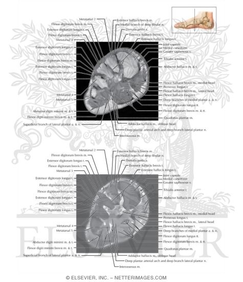 Ankle and Foot Coronal 5