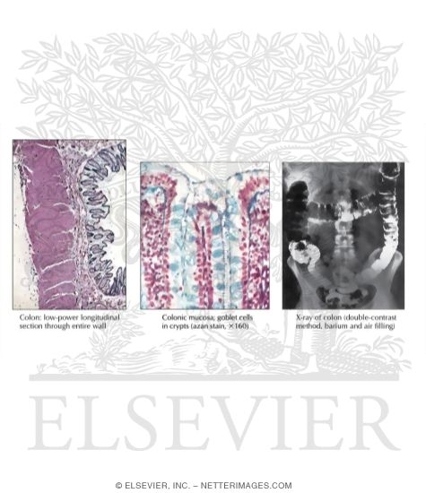 Barium Radiograph and Histology of the Large Intestine
