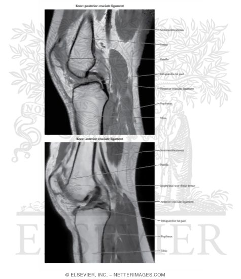 Knee: Anterior and Posterior Cruciate Ligaments