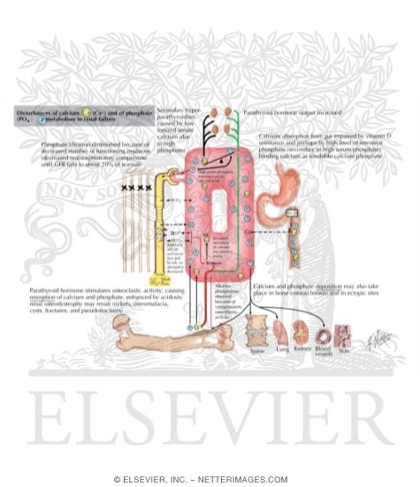 Renal Failure: Calcium and Phosphorus Metabolism