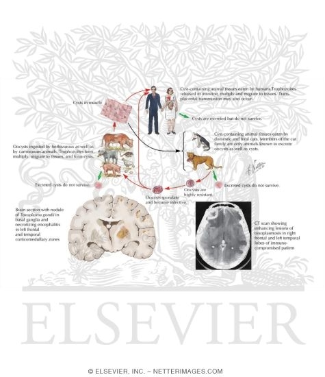 Toxoplasmosis