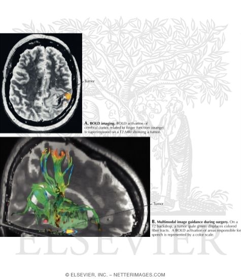 Future Developments In Imaging