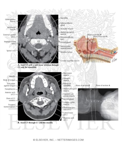 Pharynx: Median Section