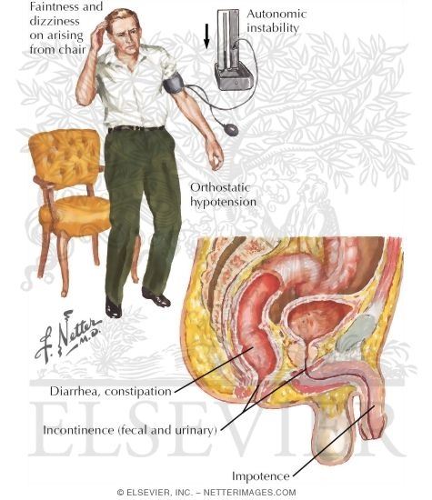 Symptoms of Dysautonomia With Polyneuropathies