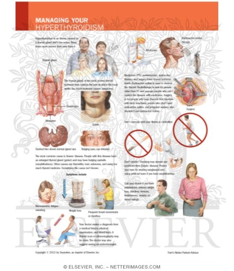 Managing Your Hyperthyroidism