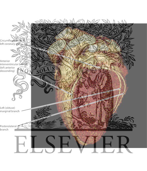 Coronary Vessel...