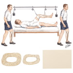 Effects of Disuse and Stress (Weight Bearing) on Bone Mass