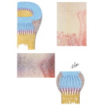 Peripheral Fibrocartilaginous Element of Growth Plate
