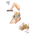 Arteries of the Foot and Ankle