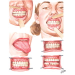 Oral Manifestations Related to Endocrine System