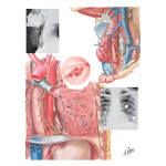Esophageal Rupture and Perforation