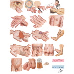 Physical Diagnosis of Liver Disease