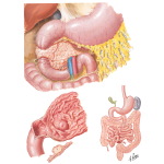 Congenital Anomalies