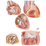 Nonpenetrating Heart Wounds 