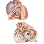 Rheumatic Heart Disease XII - Tricuspid Stenosis and Insufficiency