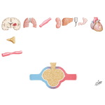The Various Causes of Pulmonary Edema