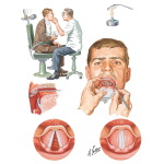 Examination of the Larynx