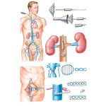 Surgical Defenses Against Massive Pulmonary Embolism