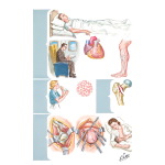 Predisposing Factors for Pulmonary Embolism