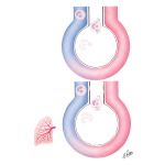 Hypothesis of the Role of Alpha1-Antitrypsin