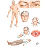 Unlabeled image