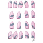 Radiographic Consolidation Patterns of Each Segment of Lungs (AP views)