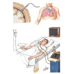 Intensive Medical Management of Severe Head Injury